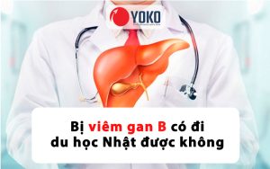 bi-viem-gan-b-co-di-du-hoc-nhat-duoc-khong